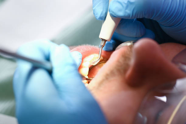 Best Pediatric Emergency Dentist in Fredonia, AZ